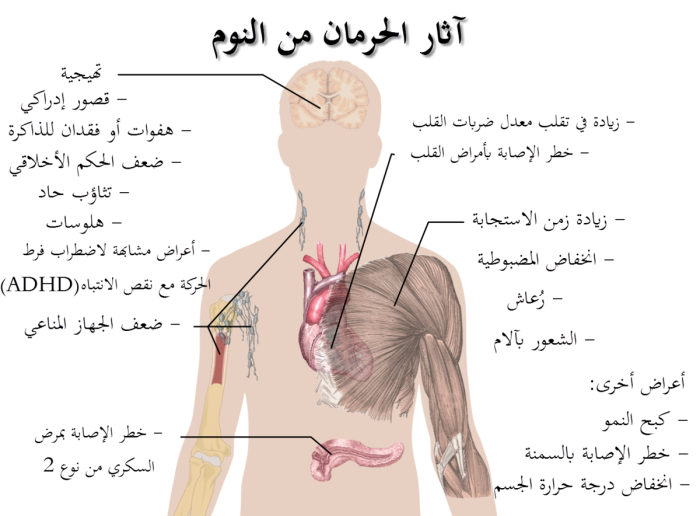 أهم أسباب الأرق وعلاجه 