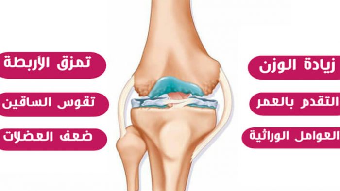 أهم أسباب ألم الركبة