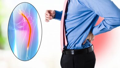 طريقة علاج مرض عرق النسا