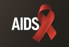 الأعراض الأولية للإيدز مشابهة للأنفلونزا